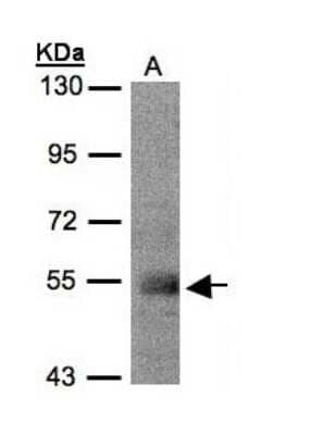 Western Blot: PACSIN1 Antibody [NBP1-32324] - Sample(30 ug of whole cell lysate)A:MOLT4 7. 5% SDS PAGE, antibody diluted at 1:500.