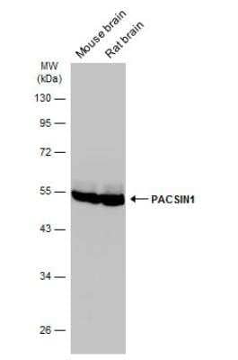 Western Blot: PACSIN1 Antibody [NBP1-32324] - Various tissue extracts (50 ug) were separated by 10% SDS-PAGE, and the membrane was blotted with PACSIN1 antibody diluted at 1:10000. The HRP-conjugated anti-rabbit IgG antibody (NBP2-19301) was used to detect the primary antibody.