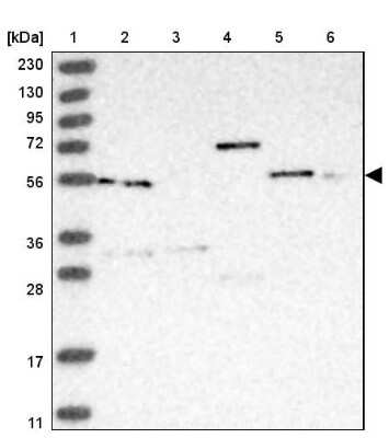 Western Blot: PACSIN1 Antibody [NBP1-87067] - Lane 1: Marker  [kDa] 230, 130, 95, 72, 56, 36, 28, 17, 11.  Lane 2: Human cell line RT-4.  Lane 3: Human cell line U-251MG sp.  Lane 4: Human plasma (IgG/HSA depleted).  Lane 5: Human liver tissue.  Lane 6: Human tonsil tissue