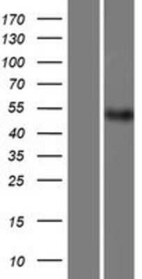 Western Blot: PACSIN1 Overexpression Lysate (Adult Normal) [NBP2-06588] Left-Empty vector transfected control cell lysate (HEK293 cell lysate); Right -Over-expression Lysate for PACSIN1.