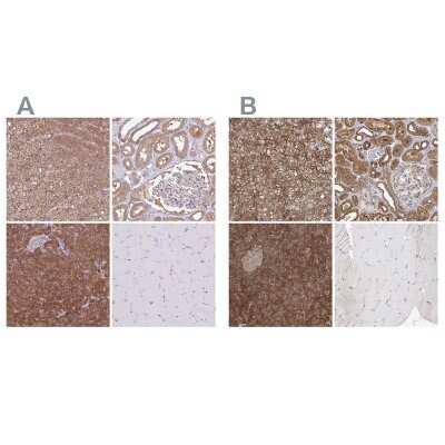 <b>Independent Antibodies Validation and Orthogonal Strategies Validation.</b>Immunohistochemistry-Paraffin: PACSIN2 Antibody [NBP2-13723] - Staining of human adrenal gland, kidney, pancreas and skeletal muscle using Anti-PACSIN2 antibody NBP2-13723 (A) shows similar protein distribution across tissues to independent antibody NBP2-56701 (B).