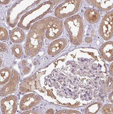 Immunohistochemistry-Paraffin: PACSIN2 Antibody [NBP2-13723] - Staining of human kidney shows weak to moderate cytoplasmic positivity in cells in tubules.