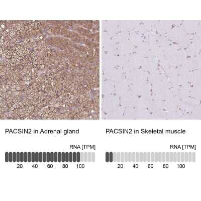 Immunohistochemistry-Paraffin: PACSIN2 Antibody [NBP2-13723] - Staining in human adrenal gland and skeletal muscle tissues using NBP2-13723 antibody. Corresponding PACSIN2 RNA-seq data are presented for the same tissues.