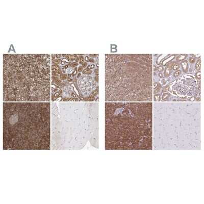 <b>Independent Antibodies Validation. </b>Immunohistochemistry-Paraffin: PACSIN2 Antibody [NBP2-56701] - Staining of human adrenal gland, kidney, pancreas and skeletal muscle using Anti-PACSIN2 antibody NBP2-56701 (A) shows similar protein distribution across tissues to independent antibody NBP2-13723 (B).