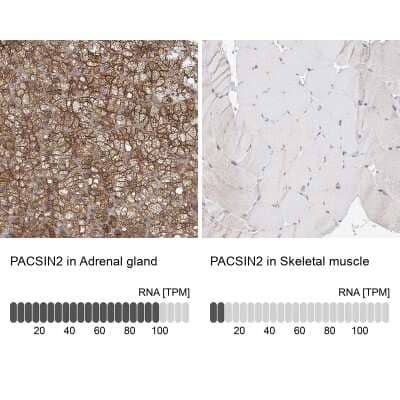 Immunohistochemistry-Paraffin: PACSIN2 Antibody [NBP2-56701] - Staining in human adrenal gland and skeletal muscle tissues using NBP2-56701 antibody. Corresponding PACSIN2 RNA-seq data are presented for the same tissues.