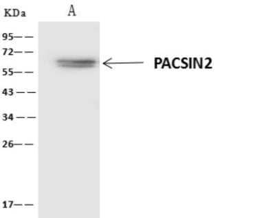 Immunoprecipitation: PACSIN2 Antibody [NBP3-06469] - Lane A:0.5 mg NIH/3T3 Whole Cell Lysate4 uL anti-PACSIN2 rabbit polyclonal antibody and 60 ug of Immunomagnetic beads Protein A/G.Primary antibody:Anti-PACSIN2 rabbit polyclonal antibody,at 1:100 dilution Secondary antibody:Clean-Blot IP Detection Reagent (HRP) at 1:1000dilutionDeveloped using the ECL technique.Performed under reducing conditions.Predicted band size: 56 kDaObserved band size :60 kDa