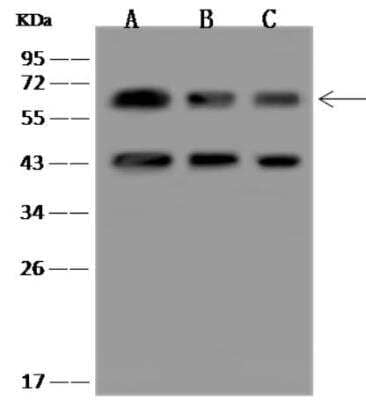 Western Blot: PACSIN2 Antibody [NBP3-06469] - Lane A: Jurkat Whole Cell LysateLane B: NIH/3T3 Whole Cell LysateLane C: RAW 264.7 Whole Cell LysateLysates/proteins at 30 ug per lane.SecondaryGoat Anti-Rabbit IgG (H+L)/HRP at 1/10000 dilution.Developed using the ECL technique.Performed under reducing conditions.Predicted band size:55 kDaObserved band size:62 kDa(We are unsure as to the identity of these extra bands.)