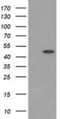 Western Blot: PACSIN3 Antibody (OTI2A3) - Azide and BSA Free [NBP2-73223] - HEK293T cells were transfected with the pCMV6-ENTRY control (Left lane) or pCMV6-ENTRY PACSIN3 (Right lane) cDNA for 48 hrs and lysed. Equivalent amounts of cell lysates (5 ug per lane) were separated by SDS-PAGE and immunoblotted with anti-PACSIN3.