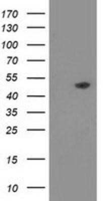 Western Blot: PACSIN3 Antibody (OTI4F8) - Azide and BSA Free [NBP2-73221] - HEK293T cells were transfected with the pCMV6-ENTRY control (Left lane) or pCMV6-ENTRY PACSIN3 (Right lane) cDNA for 48 hrs and lysed. Equivalent amounts of cell lysates (5 ug per lane) were separated by SDS-PAGE and immunoblotted with anti-PACSIN3.