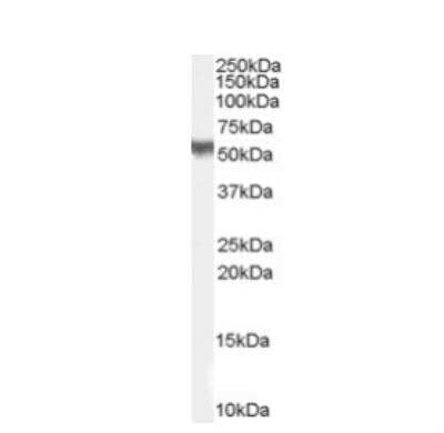 Western Blot: PACSIN3 Antibody [NB100-862] - Staining (1 ug/ml) of H460 lysate (RIPA buffer, 35 ug total protein per lane). Primary incubated for 1 hour. Detected by western blot using chemiluminescence.