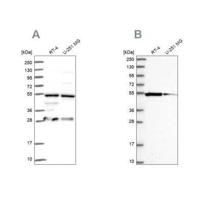 Western Blot: PACSIN3 Antibody [NBP2-47339] - Analysis using Anti-PACSIN3 antibody NBP2-47339 (A) shows similar pattern to independent antibody NBP2-48707 (B).