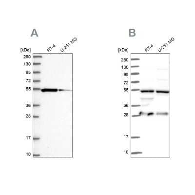 Western Blot: PACSIN3 Antibody [NBP2-48707] - Analysis using Anti-PACSIN3 antibody NBP2-48707 (A) shows similar pattern to independent antibody NBP2-47339 (B).