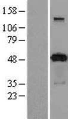 Western Blot: PACSIN3 Overexpression Lysate (Adult Normal) [NBL1-14060] Left-Empty vector transfected control cell lysate (HEK293 cell lysate); Right -Over-expression Lysate for PACSIN3.