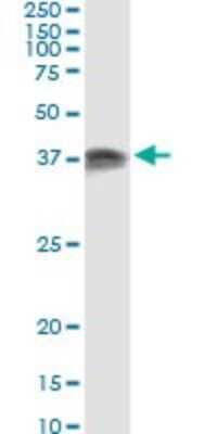 Immunoprecipitation: PACT Antibody (1B9-1A7) [H00008575-M01] - Analysis of PRKRA transfected lysate using anti-PRKRA monoclonal antibody and Protein A Magnetic Bead, and immunoblotted with PRKRA MaxPab rabbit polyclonal antibody.