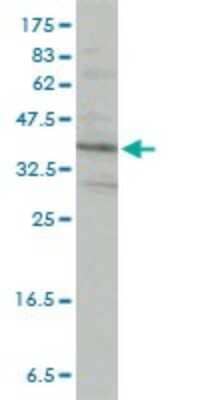 Western Blot: PACT Antibody (1B9-1A7) [H00008575-M01] - PRKRA monoclonal antibody (M01), clone 1B9-1A7 Analysis of PRKRA expression in HeLa.