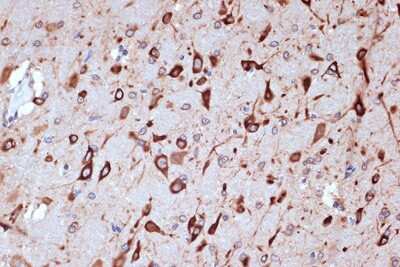 Immunohistochemistry-Paraffin: PACT Antibody (2W2E10) [NBP3-16701] - Immunohistochemistry of paraffin-embedded rat brain using PACTRabbit mAb (NBP3-16701) at dilution of 1:100 (40x lens).Perform microwave antigen retrieval with 10 mM Tris/EDTA buffer pH 9.0 before commencing with IHC staining protocol.