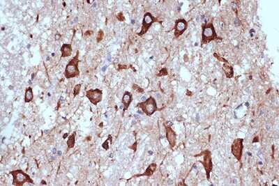 Immunohistochemistry-Paraffin: PACT Antibody (2W2E10) [NBP3-16701] - Immunohistochemistry of paraffin-embedded human brain using PACTRabbit mAb (NBP3-16701) at dilution of 1:100 (40x lens).Perform microwave antigen retrieval with 10 mM Tris/EDTA buffer pH 9.0 before commencing with IHC staining protocol.