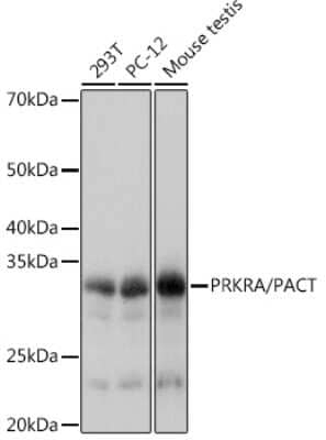 Western Blot: PACT Antibody (2W2E10) [NBP3-16701] - Western blot analysis of extracts of various cell lines, using PACTRabbit mAb (NBP3-16701) at 1:1000 dilution. Secondary antibody: HRP Goat Anti-Rabbit IgG (H+L) at 1:10000 dilution. Lysates/proteins: 25ug per lane. Blocking buffer: 3% nonfat dry milk in TBST. Detection: ECL Basic Kit. Exposure time: 1s.