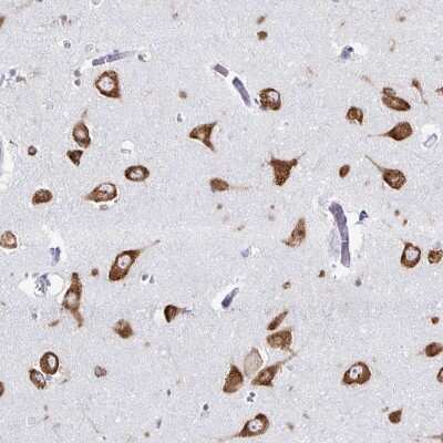 Immunohistochemistry-Paraffin: PACT Antibody [NBP2-55124] - Immunohistochemical staining of human lateral ventricle shows strong cytoplasmic positivity in neuronal cells.