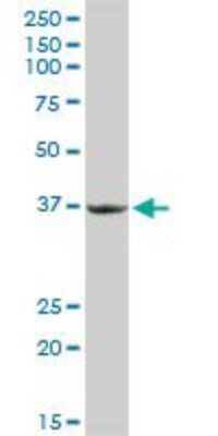 Western Blot: PACT Antibody [H00008575-D01P] - Analysis of PRKRA expression in human liver.