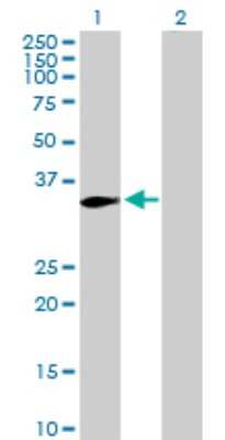 Western Blot: PACT Antibody [H00008575-D01P] - Analysis of PRKRA expression in transfected 293T cell line by PRKRA polyclonal antibody.Lane 1: PRKRA transfected lysate(34.40 KDa).Lane 2: Non-transfected lysate.