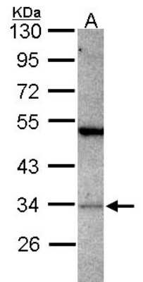 Western Blot: PACT Antibody [NBP2-19674] - Sample (30 ug of whole cell lysate) A: JurKat 10% SDS PAGE gel, diluted at 1:1000.