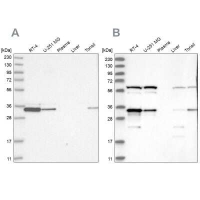 Western Blot: PACT Antibody [NBP2-55123] - Analysis using Anti-PRKRA antibody NBP2-55123 (A) shows similar pattern to independent antibody NBP2-55124 (B).