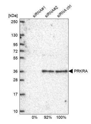 <b>Genetic Strategies Validation. </b>Western Blot: PACT Antibody [NBP2-55124] - Analysis in U2OS cells transfected with control siRNA, target specific siRNA probe #1 and #2. Remaining relative intensity is presented.