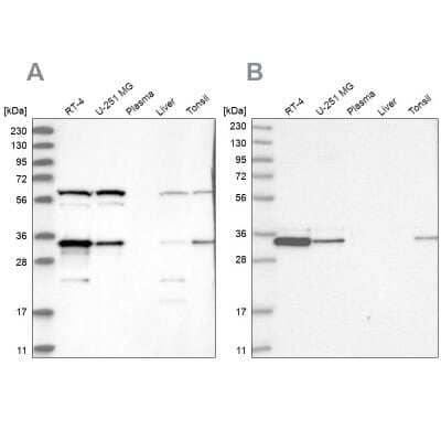 Western Blot: PACT Antibody [NBP2-55124] - Analysis using Anti-PRKRA antibody NBP2-55124 (A) shows similar pattern to independent antibody NBP2-55123 (B).