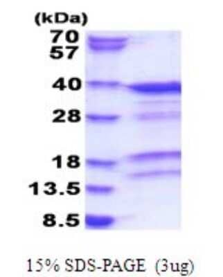 SDS-Page: Recombinant Human PACT Protein [NBP2-51787] - 15% SDS Page (3 ug)