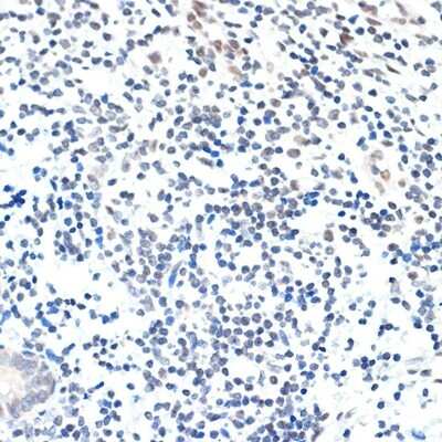 Immunohistochemistry-Paraffin: PAF1 Antibody (3U5C4) [NBP3-16185] - Immunohistochemistry of paraffin-embedded human appendix using PAF1 Rabbit mAb (NBP3-16185) at dilution of 1:100 (40x lens).Perform microwave antigen retrieval with 10 mM Tris/EDTA buffer pH 9.0 before commencing with IHC staining protocol.