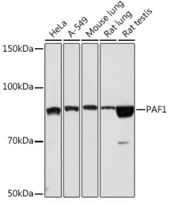 Western Blot: PAF1 Antibody (3U5C4) [NBP3-16185] - Western blot analysis of extracts of various cell lines, using PAF1 Rabbit mAb (NBP3-16185) at 1:1000 dilution. Secondary antibody: HRP Goat Anti-Rabbit IgG (H+L) at 1:10000 dilution. Lysates/proteins: 25ug per lane. Blocking buffer: 3% nonfat dry milk in TBST. Detection: ECL Basic Kit. Exposure time: 90s.