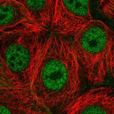 Immunocytochemistry/Immunofluorescence: PAF1 Antibody [NBP2-54958] - Staining of human cell line MCF7 shows localization to nucleoplasm & cell junctions.