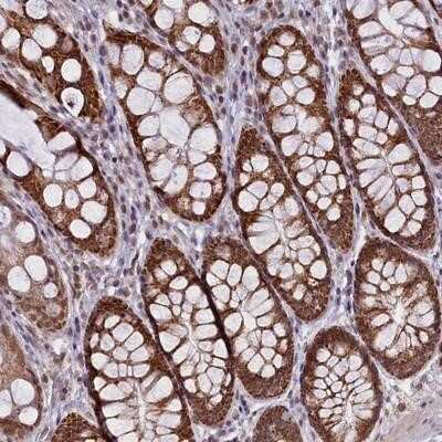 Immunohistochemistry-Paraffin: PAF1 Antibody [NBP2-13724] - Staining of human colon shows strong nuclear and cytoplasmic positivity in glandular cells.