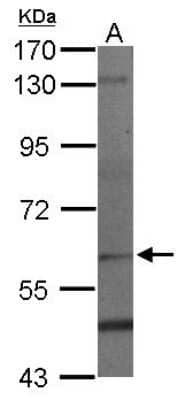 Western Blot: PAF1 Antibody [NBP2-19675] - Sample (50 ug of whole cell lysate) A: Mouse Brain, 7. 5% SDS PAGE gel, diluted at 1:1000.