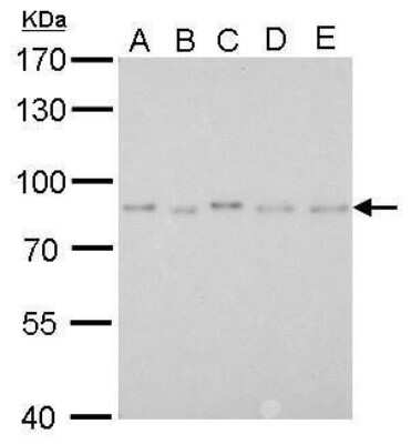 Western Blot: PAF49 Antibody (635) [NBP2-43633] - Analysis of A. 30 ug 293T whole cell lysate/extract B. 30 ug A431 whole cell lysate/extract C. 30 ug HeLa whole cell lysate/extract D. 30 ug HepG2 whole cell lysate/extract E. 30 ug A375 whole cell lysate/extract 7.5 % SDS-PAGE PAF49 antibody [635] dilution: 1:1000.