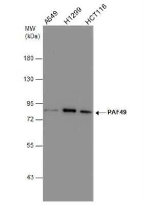 Western Blot: PAF49 Antibody (635) [NBP2-43633] - Various whole cell extracts (30 ug) were separated by 7.5% SDS-PAGE, and the membrane was blotted with PAF49 antibody diluted at 1:1000.