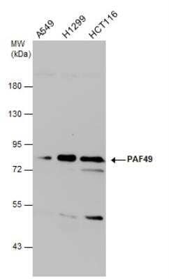 Western Blot: PAF49 Antibody (7212) [NBP2-43592] - Various whole cell extracts (30 ug) were separated by 7.5% SDS-PAGE, and the membrane was blotted with PAF49 antibody diluted at 1:500.