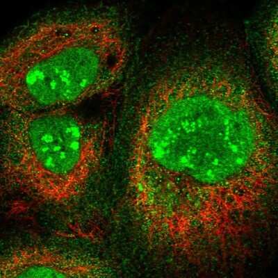 Immunocytochemistry/Immunofluorescence: PAF49 Antibody [NBP1-90085] - Staining of human cell line A-431 shows localization to nucleus, nucleoli fibrillar center & cytosol.