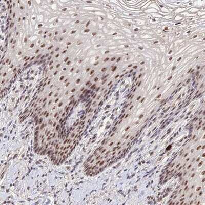 Immunohistochemistry-Paraffin: PAF49 Antibody [NBP1-90085] - Staining of human vagina shows moderate nucleolar positivity in squamous epithelial cells.