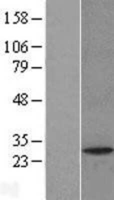 Western Blot: PAFAH1B2 Overexpression Lysate (Adult Normal) [NBL1-14065] Left-Empty vector transfected control cell lysate (HEK293 cell lysate); Right -Over-expression Lysate for PAFAH1B2.