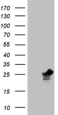 Western Blot: PAFAH1B3 Antibody (5D2) [NBP2-46314] - Analysis of HEK293T cells were transfected with the pCMV6-ENTRY control (Left lane) or pCMV6-ENTRY PAFAH1B3.