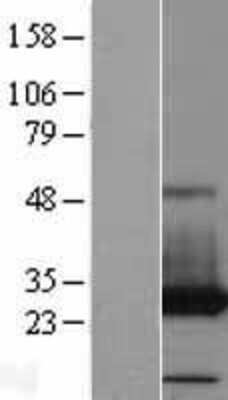 Western Blot PAFAH1B3 Overexpression Lysate