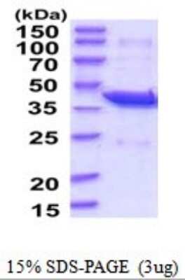 SDS-PAGE Recombinant Human PAFAH2 His Protein