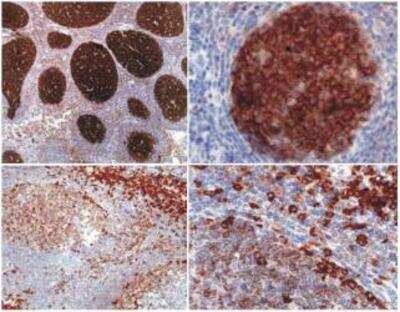 Immunohistochemistry: PAG Antibody (MEM-255) [NB500-342] - Cbp/PAG is expressed in germinal centers of lymph node lymphoid follicle and in follicular lymphoma (it is absent from mantle zone). Cbp/PAG is also expressed more weakly in T cells in tonsil and the thymic medulla.