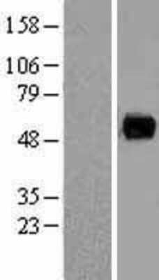 Western Blot: PAG Overexpression Lysate (Adult Normal) [NBL1-14068] Left-Empty vector transfected control cell lysate (HEK293 cell lysate); Right -Over-expression Lysate for PAG.