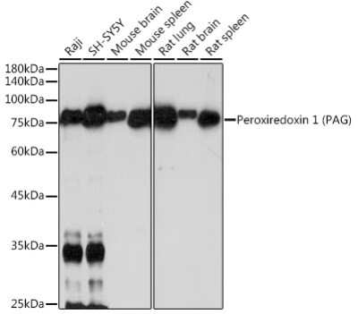 Western Blot: PAG1 Antibody (0K5F4) [NBP3-15731] - Western blot analysis of extracts of various cell lines, using Peroxiredoxin 1 (PAG1) antibody (NBP3-15731) at 1:1000 dilution. Secondary antibody: HRP Goat Anti-Rabbit IgG (H+L) at 1:10000 dilution. Lysates/proteins: 25ug per lane. Blocking buffer: 3% nonfat dry milk in TBST. Detection: ECL Basic Kit. Exposure time: 180s.