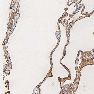 Immunohistochemistry: PAG1 Antibody [NBP1-88173] - Staining of human lung shows cytoplasmic and membranous positivity in alveolar cells.