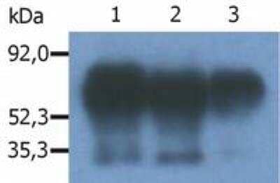 Immunoprecipitation: PAG1 Antibody (PAG-C1) [NB500-487] -  Immunoprecipitation of human Cbp/PAG from the lysate of RAJI human Burkitt lymphoma cell line. Western blot was immunostained with anti-human Cbp/PAG (MEM-255). Note: Csk-binding protein (Cbp/PAG) is a 46 kDa adaptor protein, which however migrates on SDS PAGE gels anomalously as an 80 kDa molecule. Lane 1,2: immunoprecipitation with anti-Cbp/PAG (PAG-C1) Lane 3: immunoprecipitation with anti-Cbp/PAG (polyclonal antibody).