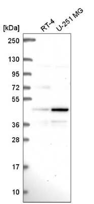 Western Blot: PAG1 Antibody [NBP2-56541] - Analysis in human cell line RT-4 and human cell line U-251 MG.